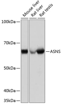 Western blot analysis of various lysates using ASNS Rabbit mAb at 1：1000 dilution.|Secondary antibody: HRP-conjugated Goat anti-Rabbit IgG (H+L) at 1:10000 dilution.|Lysates/proteins: 25μg per lane.|Blocking buffer: 3% nonfat dry milk in TBST.|Detection: ECL Basic Kit.|Exposure time: 3s.