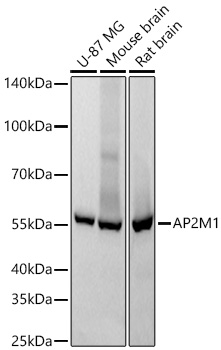 Western blot analysis of various lysates using AP2M1 Rabbit mAb at 1:1000 dilution incubated overnight at 4℃.|Secondary antibody: HRP-conjugated Goat anti-Rabbit IgG (H+L) at 1:10000 dilution.|Lysates/proteins: 25 μg per lane.|Blocking buffer: 3% nonfat dry milk in TBST.|Detection: ECL Basic Kit.|Exposure time: 10s.
