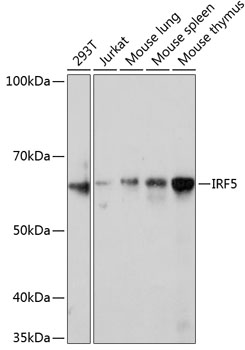 Western blot analysis of various lysates using IRF5 Rabbit mAb at 1:1000 dilution.|Secondary antibody: HRP-conjugated Goat anti-Rabbit IgG (H+L) at 1:10000 dilution.|Lysates/proteins: 25μg per lane.|Blocking buffer: 3% nonfat dry milk in TBST.|Detection: ECL Enhanced Kit.|Exposure time: 5min.