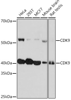 Western blot analysis of various lysates using CDK9 Rabbit mAb (A11145) at 1:1000 dilution.|Secondary antibody: HRP-conjugated Goat anti-Rabbit IgG (H+L) (AS014) at 1:10000 dilution.|Lysates/proteins: 25μg per lane.|Blocking buffer: 3% nonfat dry milk in TBST.|Detection: ECL Basic Kit (RM00020).|Exposure time: 3min.