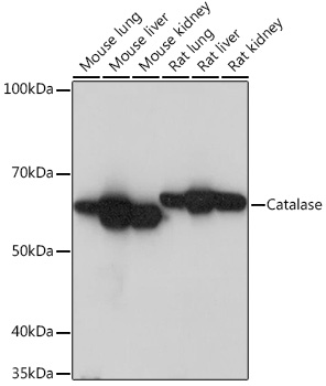 Western blot analysis of various lysates using Catalase Rabbit mAb at 1:1000 dilution.|Secondary antibody: HRP-conjugated Goat anti-Rabbit IgG (H+L) at 1:10000 dilution.|Lysates/proteins: 25μg per lane.|Blocking buffer: 3% nonfat dry milk in TBST.|Detection: ECL Basic Kit.|Exposure time: 1s.