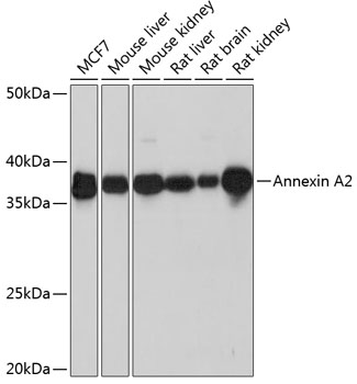 Western blot analysis of various lysates using Annexin A2 Rabbit mAb at 1:1000 dilution.|Secondary antibody: HRP-conjugated Goat anti-Rabbit IgG (H+L) at 1:10000 dilution.|Lysates/proteins: 25μg  per lane.|Blocking buffer: 3% nonfat dry milk in TBST.|Detection: ECL Basic Kit.|Exposure time: 10s.