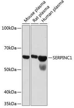 Western blot analysis of various lysates using SERPINC1  Rabbit mAb at 1：1000 dilution.|Secondary antibody: HRP-conjugated Goat anti-Rabbit IgG (H+L) at 1:10000 dilution.|Lysates/proteins: 25μg per lane.|Blocking buffer: 3% nonfat dry milk in TBST.|Detection: ECL Basic Kit.|Exposure time: 90s.
