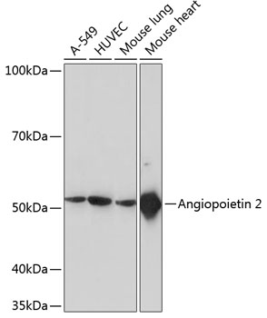 Western blot analysis of various lysates using ANGPT2 Rabbit mAb at 1：1000 dilution.|Secondary antibody: HRP-conjugated Goat anti-Rabbit IgG (H+L) at 1:10000 dilution.|Lysates/proteins: 25μg per lane.|Blocking buffer: 3% nonfat dry milk in TBST.|Detection: ECL Basic Kit.|Exposure time: 10s.