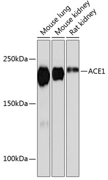 Western blot analysis of various lysates using ACE1 Rabbit mAb at 1：1000 dilution.|Secondary antibody: HRP-conjugated Goat anti-Rabbit IgG (H+L) at 1:10000 dilution.|Lysates/proteins: 25μg per lane.|Blocking buffer: 3% nonfat dry milk in TBST.|Detection: ECL Basic Kit.|Exposure time: 30s.