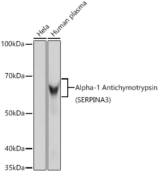Western blot analysis of various lysates using Alpha-1 Antichymotrypsin (SERPINA3) Rabbit mAb at 1:1000 dilution.|Secondary antibody: HRP-conjugated Goat anti-Rabbit IgG (H+L) at 1:10000 dilution.|Lysates/proteins: 25μg per lane.|Blocking buffer: 3% nonfat dry milk in TBST.|Detection: ECL Basic Kit.|Exposure time: 30s.