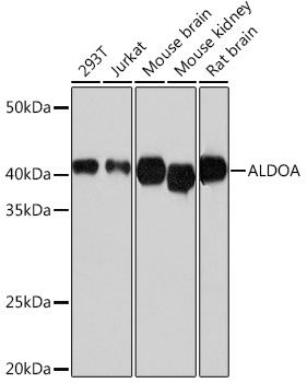 Western blot analysis of various lysates using ALDOA Rabbit mAb at 1：1000 dilution.|Secondary antibody: HRP-conjugated Goat anti-Rabbit IgG (H+L) at 1:10000 dilution.|Lysates/proteins: 25μg per lane.|Blocking buffer: 3% nonfat dry milk in TBST.|Detection: ECL Basic Kit.|Exposure time: 5s.