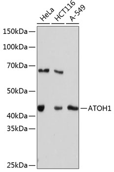 Western blot analysis of various lysates using ATOH1 Rabbit mAb at 1：1000 dilution.|Secondary antibody: HRP-conjugated Goat anti-Rabbit IgG (H+L) at 1:10000 dilution.|Lysates/proteins: 25μg per lane.|Blocking buffer: 3% nonfat dry milk in TBST.|Detection: ECL Basic Kit.|Exposure time: 3min.
