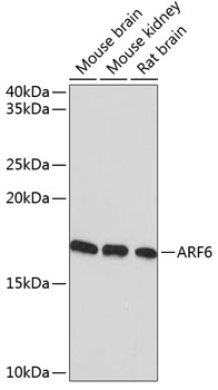 Western blot analysis of various lysates using ARF6 Rabbit mAb at 1:1000 dilution.|Secondary antibody: HRP-conjugated Goat anti-Rabbit IgG (H+L) at 1:10000 dilution.|Lysates/proteins: 25μg per lane.|Blocking buffer: 3% nonfat dry milk in TBST.|Detection: ECL Basic Kit.|Exposure time: 3min.