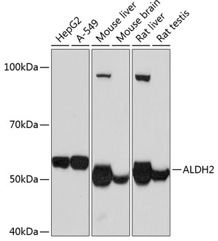 Western blot analysis of various lysates using ALDH2 Rabbit mAb at 1：1000 dilution.|Secondary antibody: HRP-conjugated Goat anti-Rabbit IgG (H+L) at 1:10000 dilution.|Lysates/proteins: 25μg per lane.|Blocking buffer: 3% nonfat dry milk in TBST.|Detection: ECL Basic Kit.|Exposure time: 5s.
