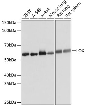 Western blot analysis of various lysates using LOX Rabbit mAb at 1:1000 dilution.|Secondary antibody: HRP-conjugated Goat anti-Rabbit IgG (H+L) at 1:10000 dilution.|Lysates/proteins: 25μg  per lane.|Blocking buffer: 3% nonfat dry milk in TBST.|Detection: ECL Basic Kit.|Exposure time: 1s.