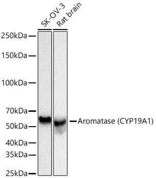 Western blot analysis of various lysates using Aromatase (CYP19A1) Rabbit mAb at 1:1000 dilution incubated at room temperature for 1.5 hours.|Secondary antibody: HRP-conjugated Goat anti-Rabbit IgG (H+L) at 1:10000 dilution.|Lysates/proteins: 25 μg per lane.|Blocking buffer: 3% nonfat dry milk in TBST.|Detection: ECL Basic Kit.|Exposure time: 1s.