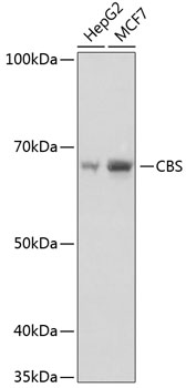 Western blot analysis of various lysates using CBS Rabbit mAb at 1:1000 dilution.|Secondary antibody: HRP-conjugated Goat anti-Rabbit IgG (H+L) at 1:10000 dilution.|Lysates/proteins: 25μg per lane.|Blocking buffer: 3% nonfat dry milk in TBST.|Detection: ECL Basic Kit.|Exposure time: 1s.