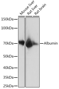 Western blot analysis of various lysates using Bovine Serum Albumin / BSA Rabbit mAb at 1:10000 dilution.|Secondary antibody: HRP-conjugated Goat anti-Rabbit IgG (H+L) at 1:10000 dilution.|Lysates/proteins: 25μg per lane.|Blocking buffer: 3% nonfat dry milk in TBST.|Detection: ECL Enhanced Kit.|Exposure time: 1s.