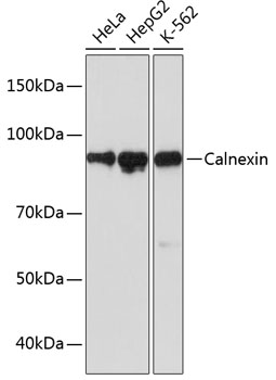 Western blot analysis of various lysates using Calnexin Rabbit mAb at 1:1000 dilution.|Secondary antibody: HRP-conjugated Goat anti-Rabbit IgG (H+L) at 1:10000 dilution.|Lysates/proteins: 25μg per lane.|Blocking buffer: 3% nonfat dry milk in TBST.|Detection: ECL Basic Kit.|Exposure time: 30s.