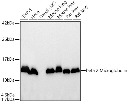 Western blot analysis of various lysates using beta 2 Microglobulin Rabbit mAbat 1:3000 dilution incubated overnight at 4℃.|Secondary antibody: HRP-conjugated Goat anti-Rabbit IgG (H+L) at 1:10000 dilution.|Lysates/proteins: 25 μg per lane.|Blocking buffer: 3% nonfat dry milk in TBST.|Detection: ECL Basic Kit.|Negative control (NC): Daudi|Exposure time: 10s.
