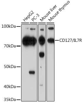 Western blot analysis of various lysates using CD127/IL7R Rabbit mAb at 1:1000 dilution.|Secondary antibody: HRP-conjugated Goat anti-Rabbit IgG (H+L) at 1:10000 dilution.|Lysates/proteins: 25μg per lane.|Blocking buffer: 3% nonfat dry milk in TBST.|Detection: ECL Basic Kit.|Exposure time: 90s.