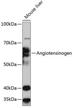 Western blot analysis of lysates from Mouse liver, using Angiotensinogen Rabbit mAb at 1:1000 dilution.|Secondary antibody: HRP-conjugated Goat anti-Rabbit IgG (H+L) at 1:10000 dilution.|Lysates/proteins: 25μg per lane.|Blocking buffer: 3% nonfat dry milk in TBST.|Detection: ECL Basic Kit.|Exposure time: 30s.