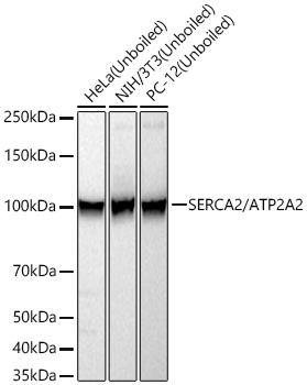 Western blot analysis of various lysates using SERCA2/ATP2A2 Rabbit mAb at 1:10000 dilution incubated at room temperature for 1.5 hours.|Secondary antibody: HRP-conjugated Goat anti-Rabbit IgG (H+L) at 1:10000 dilution.|Lysates/proteins: 25 μg per lane.|Blocking buffer: 3% nonfat dry milk in TBST.|Detection: ECL Basic Kit.|Exposure time: 60 s.