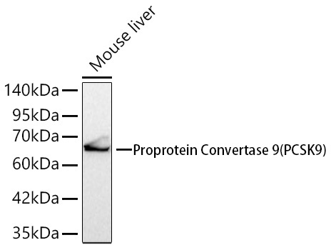 Western blot analysis of various lysates using Proprotein Convertase 9(PCSK9) Rabbit mAb at 1:1000 dilution.|Secondary antibody: HRP-conjugated Goat anti-Rabbit IgG (H+L) at 1:10000 dilution.|Lysates/proteins: 25μg per lane.|Blocking buffer: 3% nonfat dry milk in TBST.|Detection: ECL Basic Kit.|Exposure time: 10s.