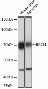 Western blot analysis of various lysates using BACE1 Rabbit mAb at 1：1000 dilution.|Secondary antibody: HRP-conjugated Goat anti-Rabbit IgG (H+L) at 1:10000 dilution.|Lysates/proteins: 25μg per lane.|Blocking buffer: 3% nonfat dry milk in TBST.|Detection: ECL Basic Kit.|Exposure time: 10s.