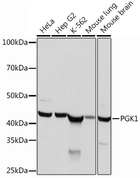 Western blot analysis of various lysates using PGK1  Rabbit mAb at 1：1000 dilution.|Secondary antibody: HRP-conjugated Goat anti-Rabbit IgG (H+L) at 1:10000 dilution.|Lysates/proteins: 25μg per lane.|Blocking buffer: 3% nonfat dry milk in TBST.|Detection: ECL Basic Kit.|Exposure time: 1s.