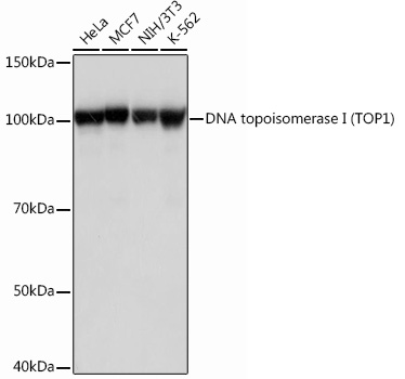 Western blot analysis of various lysates using DNA topoisomerase I (DNA topoisomerase I (TOP1)) Rabbit mAb at 1：1000 dilution.|Secondary antibody: HRP-conjugated Goat anti-Rabbit IgG (H+L) at 1:10000 dilution.|Lysates/proteins: 25μg per lane.|Blocking buffer: 3% nonfat dry milk in TBST.|Detection: ECL Basic Kit.|Exposure time: 1s.