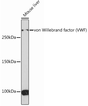 Western blot analysis of lysates from Mouse liver, using von Willebrand factor (VWF) Rabbit mAb at 1:1000 dilution.|Secondary antibody: HRP-conjugated Goat anti-Rabbit IgG (H+L) at 1:10000 dilution.|Lysates/proteins: 25μg  per lane.|Blocking buffer: 3% nonfat dry milk in TBST.|Detection: ECL Basic Kit.|Exposure time: 3min.
