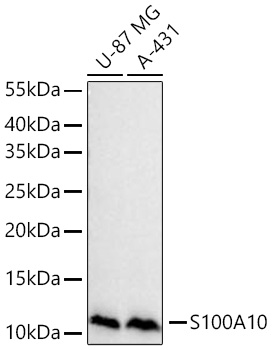 Western blot analysis of various lysates using S100A10 Rabbit mAb at 1:1000 dilution incubated at room temperature for 1.5 hours.|Secondary antibody: HRP-conjugated Goat anti-Rabbit IgG (H+L) at 1:10000 dilution.|Lysates/proteins: 25 μg per lane.|Blocking buffer: 3% nonfat dry milk in TBST.|Detection: ECL Basic Kit.|Exposure time: 45s.