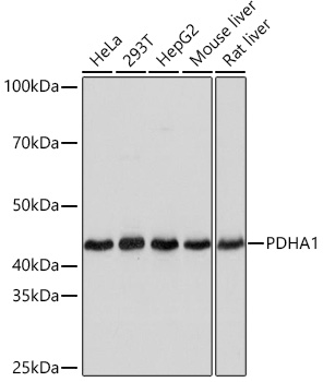 Western blot analysis of various lysates using PDHA1 Rabbit mAb at 1:1000 dilution.|Secondary antibody: HRP-conjugated Goat anti-Rabbit IgG (H+L) at 1:10000 dilution.|Lysates/proteins: 25μg per lane.|Blocking buffer: 3% nonfat dry milk in TBST.|Detection: ECL Basic Kit.|Exposure time: 3s.