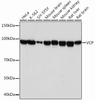 Western blot analysis of various lysates using VCP Rabbit mAb (A1402) at 1：1000 dilution.|Secondary antibody: HRP-conjugated Goat anti-Rabbit IgG (H+L) (AS014) at 1:10000 dilution.|Lysates/proteins: 25μg per lane.|Blocking buffer: 3% nonfat dry milk in TBST.|Detection: ECL Basic Kit (RM00020).|Exposure time: 10s.