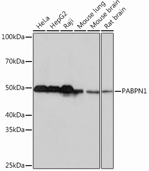 Western blot analysis of various lysates using PABPN1 Rabbit mAb at 1：1000 dilution.|Secondary antibody: HRP-conjugated Goat anti-Rabbit IgG (H+L) at 1:10000 dilution.|Lysates/proteins: 25μg per lane.|Blocking buffer: 3% nonfat dry milk in TBST.|Detection: ECL Basic Kit.|Exposure time: 10s.