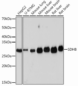 Western blot analysis of various lysates using SDHB Rabbit mAb at 1：1000 dilution.|Secondary antibody: HRP-conjugated Goat anti-Rabbit IgG (H+L) at 1:10000 dilution.|Lysates/proteins: 25μg per lane.|Blocking buffer: 3% nonfat dry milk in TBST.|Detection: ECL Basic Kit.|Exposure time: 3min.
