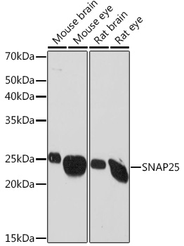 Western blot analysis of various lysates using SNAP25 Rabbit mAb at 1:1000 dilution.|Secondary antibody: HRP-conjugated Goat anti-Rabbit IgG (H+L) at 1:10000 dilution.|Lysates/proteins: 25μg per lane.|Blocking buffer: 3% nonfat dry milk in TBST.|Detection: ECL Basic Kit.|Exposure time: 30s.