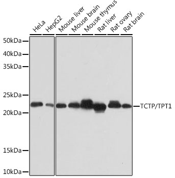 Western blot analysis of various lysates using TCTP/TPT1 Rabbit mAb (A2394) at 1:1000 dilution.|Secondary antibody: HRP-conjugated Goat anti-Rabbit IgG (H+L) (AS014) at 1:10000 dilution.|Lysates/proteins: 25μg per lane.|Blocking buffer: 3% nonfat dry milk in TBST.|Detection: ECL Basic Kit (RM00020).|Exposure time: 10s.