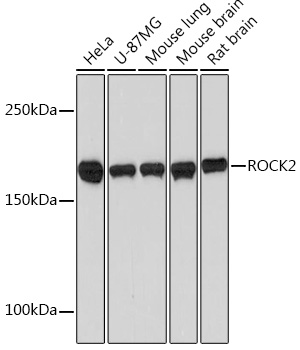 Western blot analysis of various lysates using ROCK2  Rabbit mAb at 1：1000 dilution.|Secondary antibody: HRP-conjugated Goat anti-Rabbit IgG (H+L) at 1:10000 dilution.|Lysates/proteins: 25μg per lane.|Blocking buffer: 3% nonfat dry milk in TBST.|Detection: ECL Basic Kit.|Exposure time: 90s.