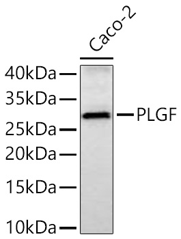 Western blot analysis of lysates from Caco-2 cells using PLGF Rabbit mAb at 1:1000 dilution incubated overnight at 4℃.|Secondary antibody: HRP-conjugated Goat anti-Rabbit IgG (H+L) at 1:10000 dilution.|Lysates/proteins: 25 μg per lane.|Blocking buffer: 3% nonfat dry milk in TBST.|Detection: ECL Basic Kit.|Exposure time: 45 s.