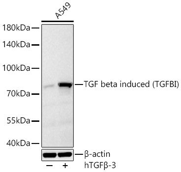 Western blot analysis of lysates from A549 cells using TGF beta induced (TGFBI) Rabbit mAb (A2407) at 1:1000 dilution incubated overnight at 4℃. A549 treated with hTGFβ-3 (100 ng/ml) at 37℃ for 16 hours.|Secondary antibody: HRP-conjugated Goat anti-Rabbit IgG (H+L) (AS014) at 1:10000 dilution.|Lysates/proteins: 30 μg per lane.| Blocking buffer: 3 % nonfat dry milk in TBST.| Detection: ECL Basic Kit (RM00020).| Exposure time: 45 s.