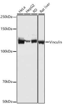 Western blot analysis of various lysates using Vinculin Rabbit mAb (A23468) at 1:1000 dilution.|Secondary antibody: HRP-conjugated Goat anti-Rabbit IgG (H+L) (AS014) at 1:10000 dilution.|Lysates/proteins: 25μg per lane.|Blocking buffer: 3% nonfat dry milk in TBST.|Detection: ECL Basic Kit (RM00020).|Exposure time: 1s.