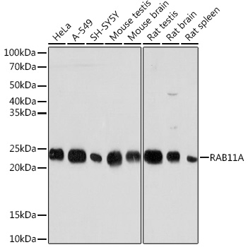 Western blot analysis of various lysates using RAB11A Rabbit mAb at 1:1000 dilution.|Secondary antibody: HRP-conjugated Goat anti-Rabbit IgG (H+L) at 1:10000 dilution.|Lysates/proteins: 25μg  per lane.|Blocking buffer: 3% nonfat dry milk in TBST.|Detection: ECL Basic Kit.|Exposure time: 3min.