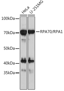 Western blot analysis of various lysates using RPA70/RPA1 Rabbit mAb at 1：1000 dilution.|Secondary antibody: HRP-conjugated Goat anti-Rabbit IgG (H+L) at 1:10000 dilution.|Lysates/proteins: 25μg per lane.|Blocking buffer: 3% nonfat dry milk in TBST.|Detection: ECL Basic Kit.|Exposure time: 30s.