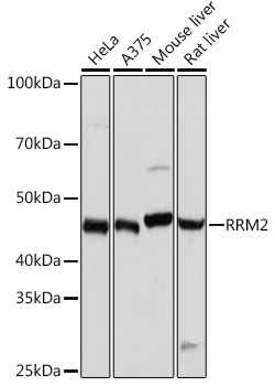 Western blot analysis of various lysates using RRM2 Rabbit mAb at 1：1000 dilution.|Secondary antibody: HRP-conjugated Goat anti-Rabbit IgG (H+L) at 1:10000 dilution.|Lysates/proteins: 25μg per lane.|Blocking buffer: 3% nonfat dry milk in TBST.|Detection: ECL Basic Kit.|Exposure time: 1s.