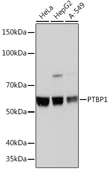 Western blot analysis of various lysates using PTBP1 Rabbit mAb at 1：1000 dilution.|Secondary antibody: HRP-conjugated Goat anti-Rabbit IgG (H+L) at 1:10000 dilution.|Lysates/proteins: 25μg per lane.|Blocking buffer: 3% nonfat dry milk in TBST.|Detection: ECL Basic Kit.|Exposure time: 1s.