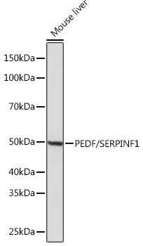 Western blot analysis of lysates from Mouse liver, using PEDF/SERPINF1 Rabbit mAb at 1：1000 dilution.|Secondary antibody: HRP-conjugated Goat anti-Rabbit IgG (H+L) at 1:10000 dilution.|Lysates/proteins: 25μg per lane.|Blocking buffer: 3% nonfat dry milk in TBST.|Detection: ECL Basic Kit.|Exposure time: 1s.