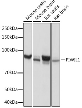 Western blot analysis of various lysates using PIWIL1 Rabbit mAb at 1：1000 dilution.|Secondary antibody: HRP-conjugated Goat anti-Rabbit IgG (H+L) at 1:10000 dilution.|Lysates/proteins: 25μg per lane.|Blocking buffer: 3% nonfat dry milk in TBST.|Detection: ECL Basic Kit.|Exposure time: 1s.