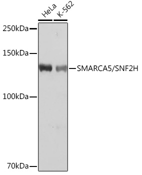 Western blot analysis of various lysates using SMARCA5/SMARCA5/SNF2H Rabbit mAb at 1:1000 dilution.|Secondary antibody: HRP-conjugated Goat anti-Rabbit IgG (H+L) at 1:10000 dilution.|Lysates/proteins: 25μg per lane.|Blocking buffer: 3% nonfat dry milk in TBST.|Detection: ECL Basic Kit.|Exposure time: 1s.