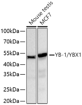 Western blot analysis of various lysates using YB-1/YBX1 Rabbit mAb (A3534) at 1:5000 dilution incubated at room temperature for 1.5 hours.|Secondary antibody: HRP-conjugated Goat anti-Rabbit IgG (H+L) (AS014) at 1:10000 dilution.|Lysates/proteins: 25 μg per lane.|Blocking buffer: 3% nonfat dry milk in TBST.|Detection: ECL Basic Kit (RM00020).|Exposure time: 20 s.