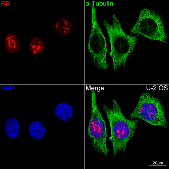 Confocal imaging of U-2 OS cells using RB Rabbit mAb(Red). The cells were counterstained with α-Tubulin Mouse mAb (Green). DAPI was used for nuclear staining (blue). Objective: 100x.