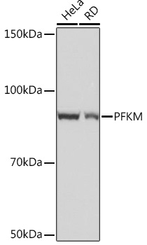 Western blot analysis of various lysates using PFKM Rabbit mAb at 1:1000 dilution incubated overnight at 4℃.|Secondary antibody: HRP-conjugated Goat anti-Rabbit IgG (H+L) at 1:10000 dilution.|Lysates/proteins: 25 μg per lane.|Blocking buffer: 3% nonfat dry milk in TBST.|Detection: ECL Basic Kit.|Exposure time: 10 s.