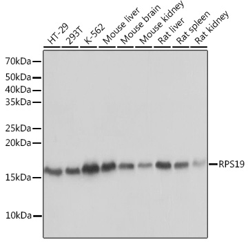 Western blot analysis of various lysates using RPS19 Rabbit mAb at 1:1000 dilution.|Secondary antibody: HRP-conjugated Goat anti-Rabbit IgG (H+L) at 1:10000 dilution.|Lysates/proteins: 25μg per lane.|Blocking buffer: 3% nonfat dry milk in TBST.|Detection: ECL Basic Kit.|Exposure time: 1s.
